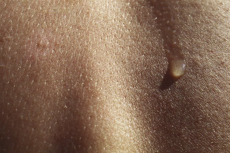 Close-up de pele, uma gota de água deslizando para baixo